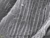 чешуйка моли застрявшая в волосках лапки Formica truncorum, комбинация двух изображений