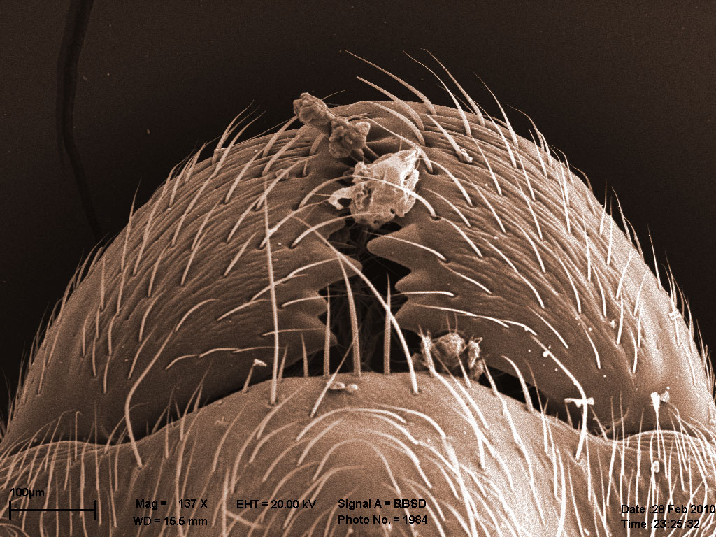 мандибулы, матка Lasius sp., хорошо видны 2 клеща мандибулы, матка Lasius sp., хорошо видны 2 клеща