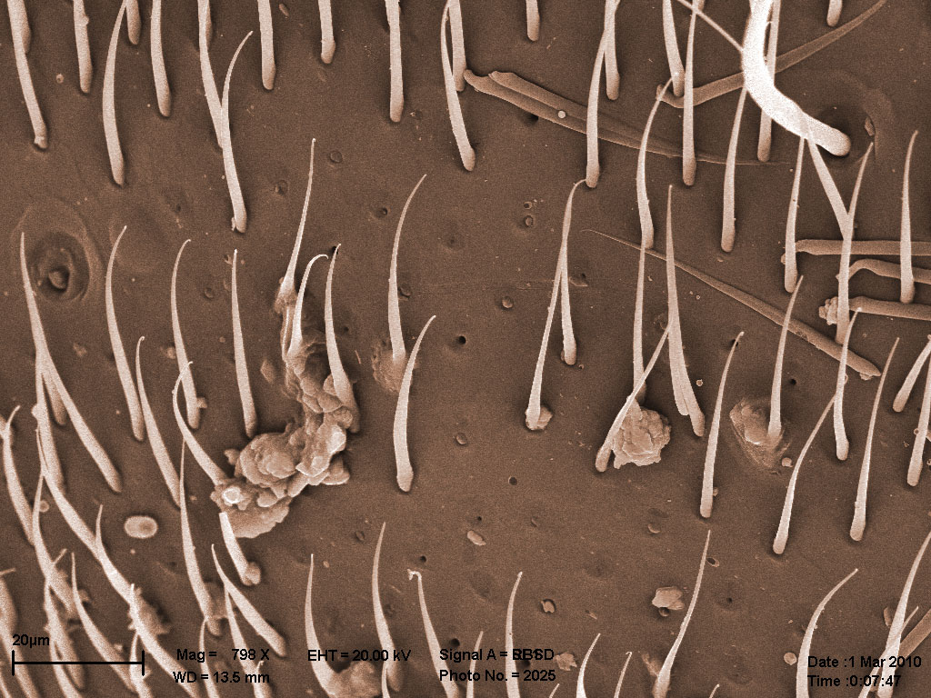 поверхность скутума, матка Lasius sp., увеличенный фрагмент предыдущего изображения поверхность скутума, матка Lasius sp., увеличенный фрагмент предыдущего изображения